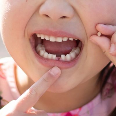 子ども歯の生え変わりのタイミングは早い方が良い？遅い方が良い？
